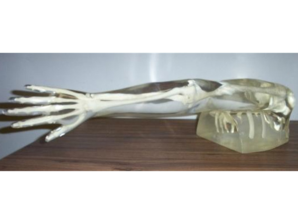 美国RSD模体 完整手臂肩膀模型模体